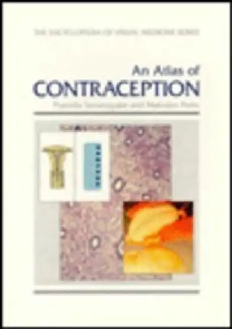 Atlas Of Contraception by I. Pramilla Senanayake, Malcolm Potts