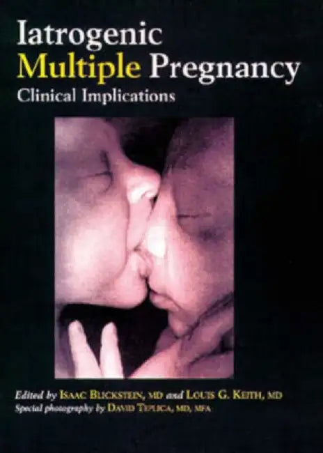 Iatrogenic Multiple Pregnancy: Clinical Implications by Isaac Blickstein, L.G. Keith
