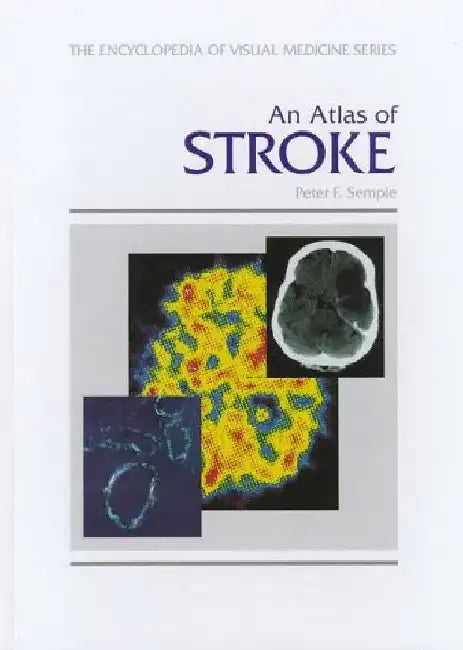 An Atlas of Stroke by Peter F. Semple