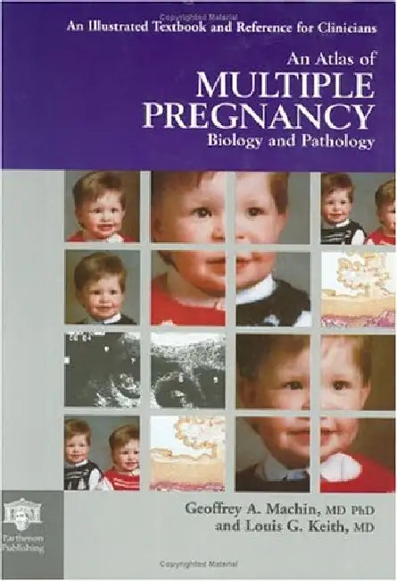 An Atlas Of Multiple Pregnancy: Biology and Pathology