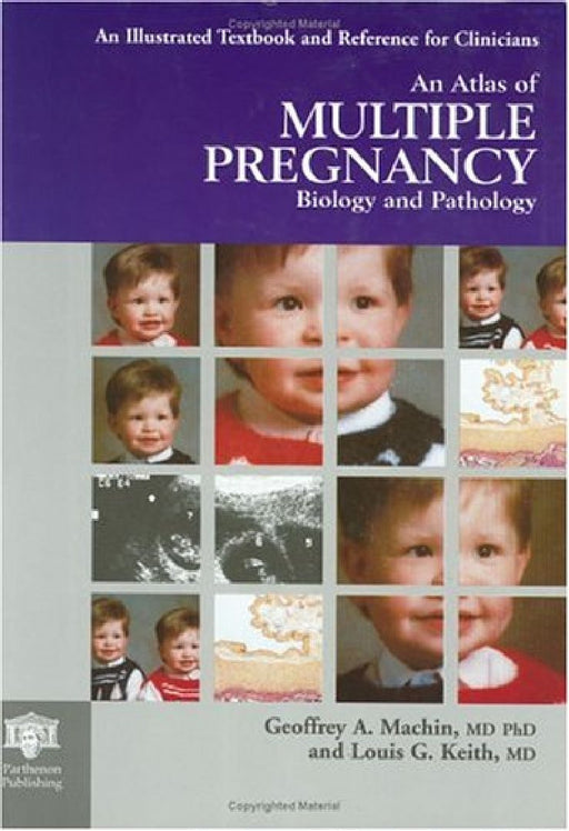 An Atlas Of Multiple Pregnancy: Biology and Pathology by G.A. Machin