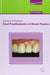 Fixed Prosthodontics in Dental Practice: Prosthodontics 4 by Michael O'Sullivan