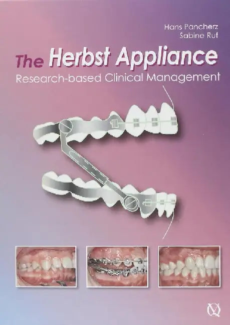 The Herbst Appliance: Research-Based Clinical Management by Hans Pancherz
