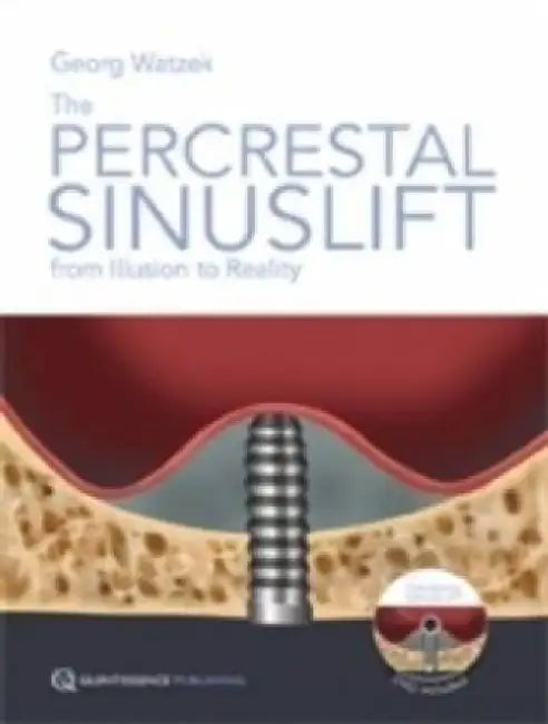 The Percrestal Sinuslift: From Illusion to Reality by George Watzek