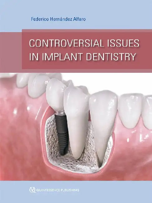 Controversial Issues in Implant Dentistry by Federico Hernandez Alfaro