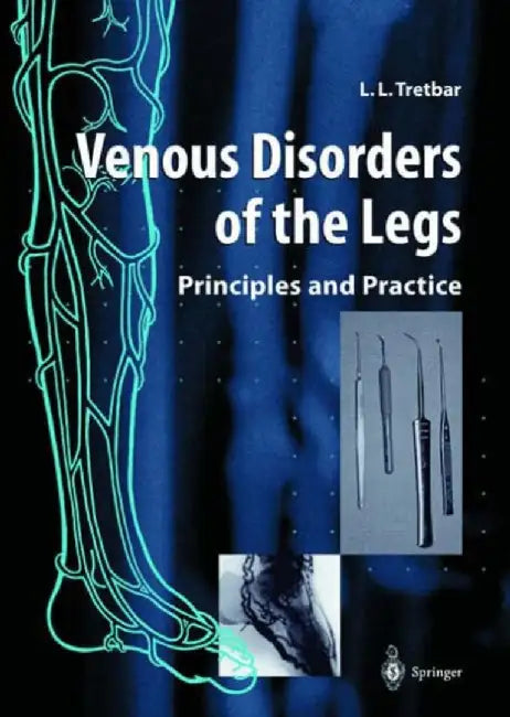 Venous Disorders Of The Legs: Principles and Practice by Lawrence L. Tretbar