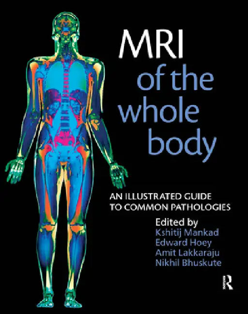 MRI of the Whole Body: An Illustrated Guide for Common Pathologies by Nikhil Bhuskute