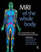 MRI of the Whole Body: An Illustrated Guide for Common Pathologies by Nikhil Bhuskute