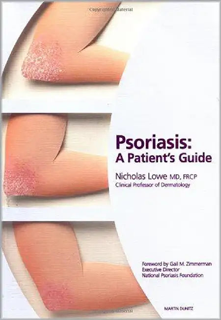 Psoriasis: A Patient's Guide by N.J. Lowe