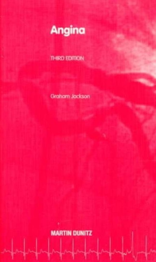 Angina: Pocketbook by Graham Jackson