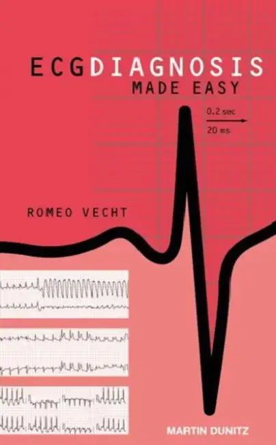 (Ex)ECG Diagnosis Made Easy With CD by Vecht