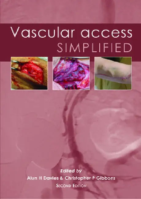 Vascular Access Simplified; Second Edition by Alun H. Davies
