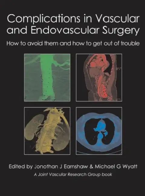Complications in Vascular and Endovascular Surgery: How to Avoid Them and How to Get Out of Trouble by Jonothan J. Earnshaw, Michael G. Wyatt