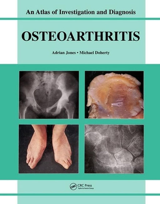 Oesteoarthritis: An Atlas of Investigation and Diagnosis by Adrian Jones, Michael Doherty