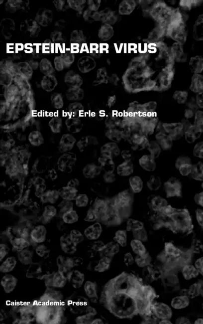 Epstein-Barr Virus by Erle S. Robertson