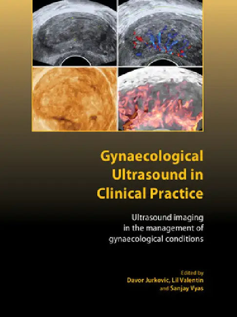 Gynaecological Ultrasound in Clinical Practice: Ultrasound Imaging in the Management of Gynaecological Conditions by Davor Jurkovic, Lil Valentin, Sanjay Vyas