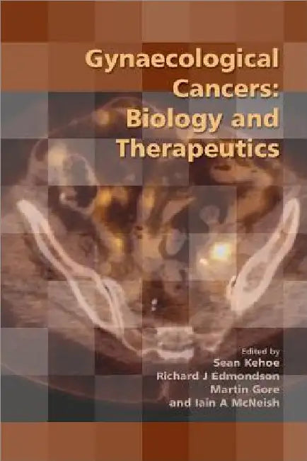 Gynaecological Cancers: Biology and Therapeutics by Sean Kehoe