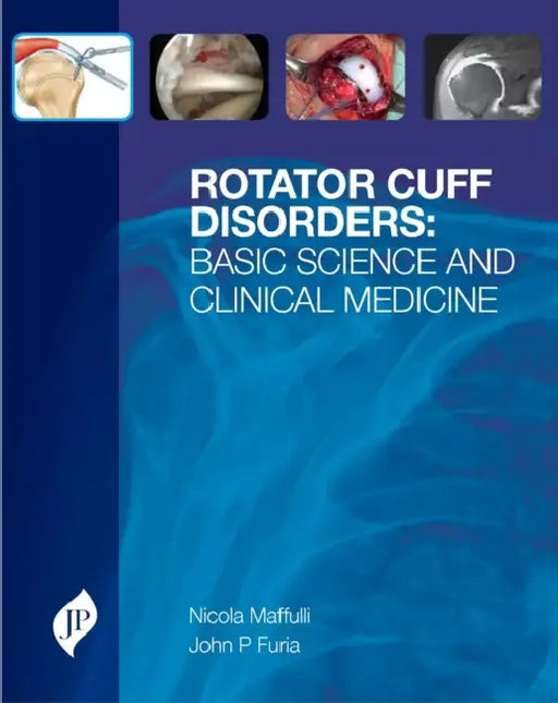 Rotator Cuff Disorders :Basic Science And Clinical Medicine by Nicola Maffulli