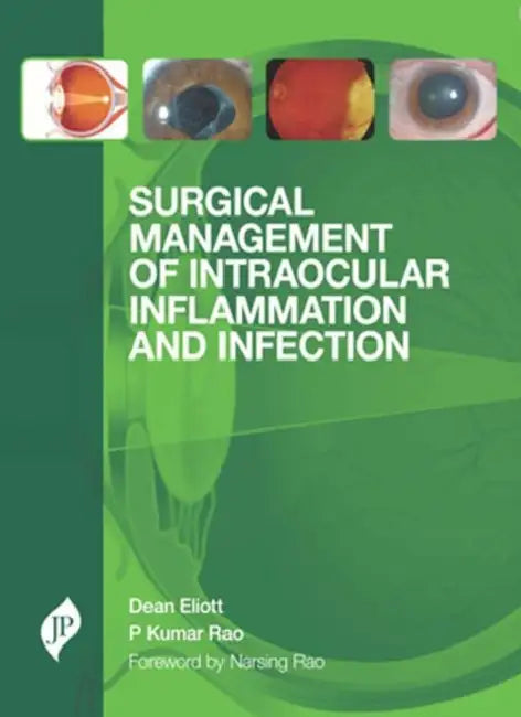 Surgical Management of Intraocular Inflammation and Infection by Dean Eliott