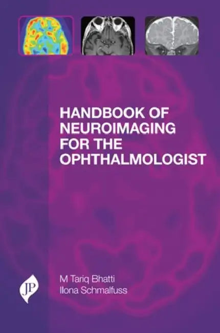 Handbook of Neuroimaging for the Ophthalmologist by Ilona Schmalfuss