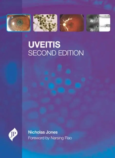 Uveitis With Cd-Rom by Nicholas Jones