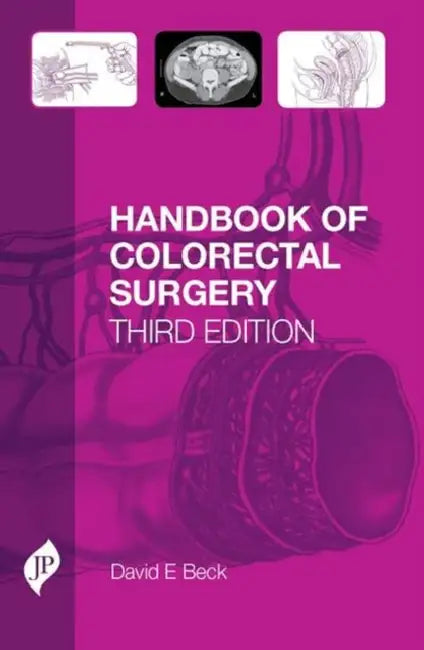 Handbook Of Colorectal Surgery by David E Beck