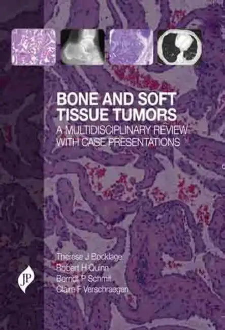 Bone and Soft Tissue Tumors: A Multidisciplinary Review with Case Presentations by Therese J Bocklage