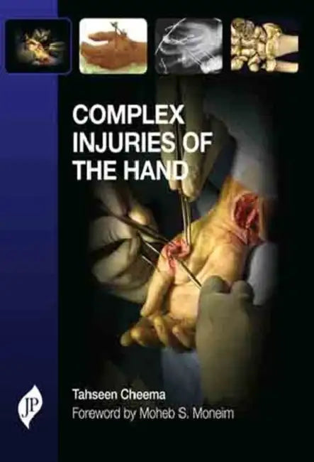 Complex Injuries Of The Hand by Tahseen A Cheema