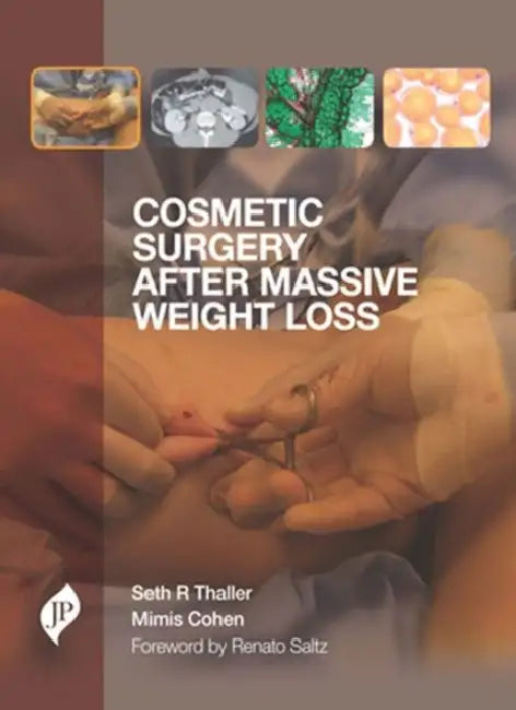 Cosmetic Surgery After Massive Weight Loss by Seth R Thaller