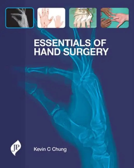 Essentials Of Hand Surgery by Kevin C Chung