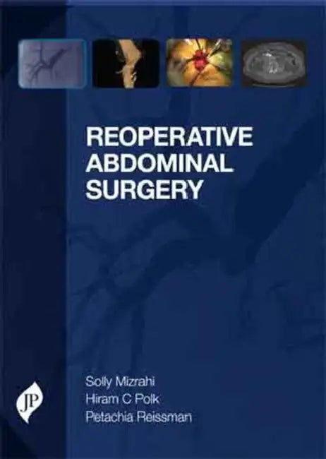 Reoperative Abdominal Surgery by Solly Mizrahi