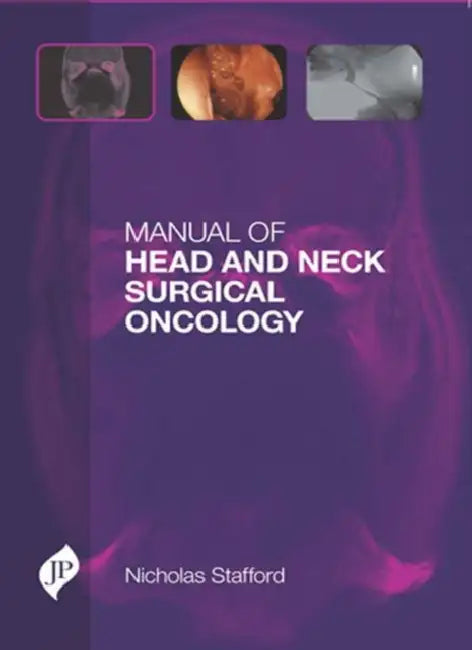 Manual Of Head And Neck Surgical Oncology by Nocholas Stafford