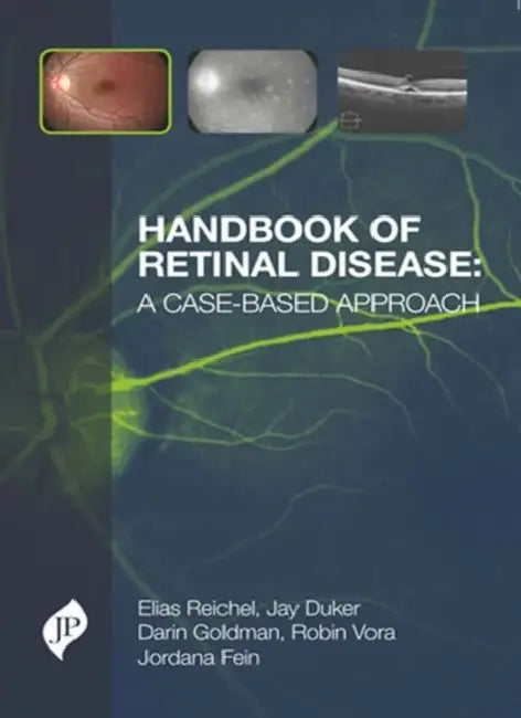 Handbook of Retinal Disease: a Case-based Approach by Guillaume Picon