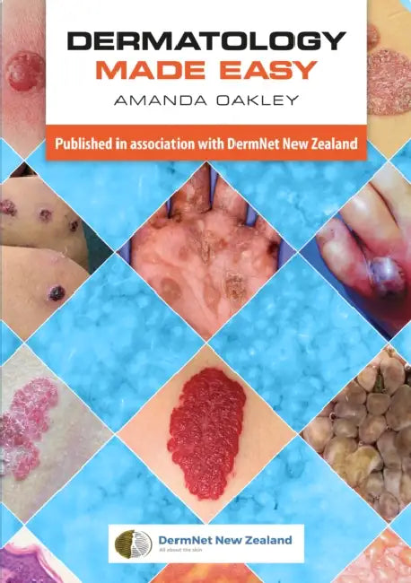 Dermatology Made Easy by Amanda Oakley