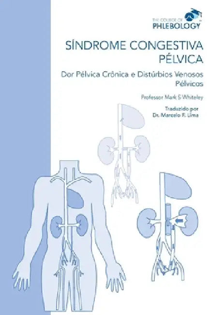 SÍNDROME CONGESTIVA PÉLVICA Dor Pélvica Crônica e Distúrbios Venosos Pélvicos by Whiteley, Mark S.