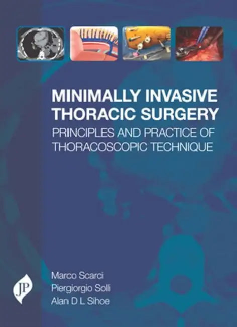 Minimally Invasive Thoracic Surgery Principles And Practice Of Thoracoscopic Technique by Marco Scarci