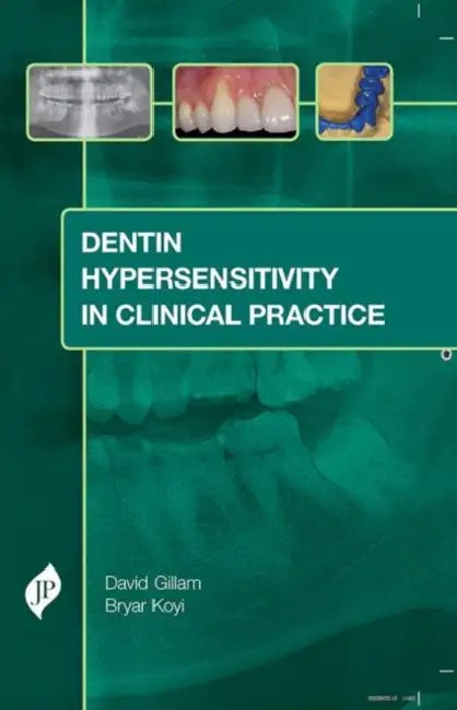 Dentin Hypersensitivity in Clinical Practice by David Gillam