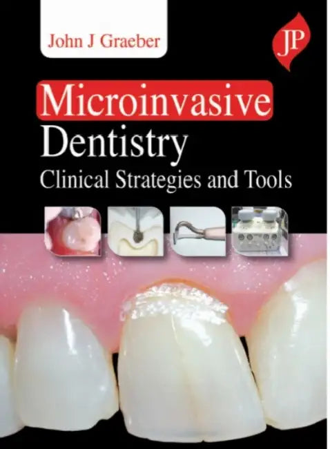 Microinvasive Dentistry: Clinical Strategies and Tools by John J Graeber