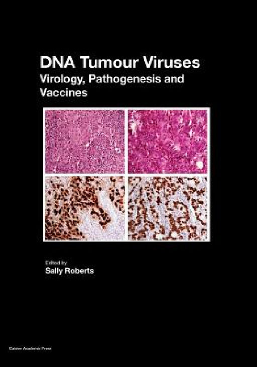DNA Tumour Viruses: Virology, Pathogenesis and Vaccines by Sally Roberts
