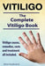 Vitiligo. Vitiligo Causes, Remedies, Costs And Treatment All Included. The Complete Vitiligo Book. by Steve Sunderland