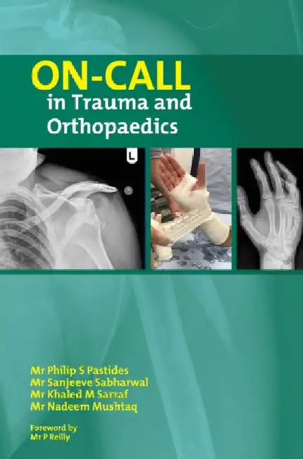 On-Call in Trauma and Orthopaedics by Nadeem Mushtaq