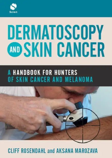 Dermatoscopy and Skin Cancer: A Handbook for Hunters of Skin Cancer and Melanoma by Cliff Rosendahl, Aksana Marozava