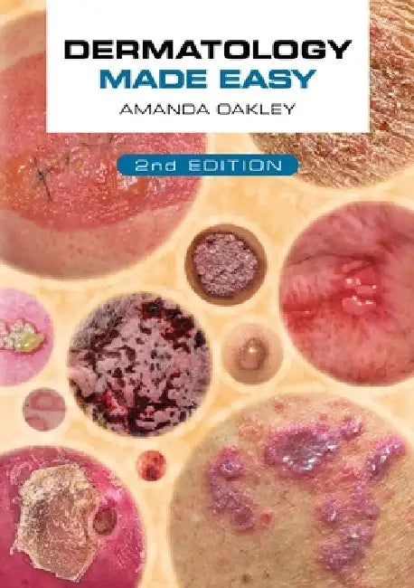 Dermatology Made Easy, Second Edition by Amanda Oakley