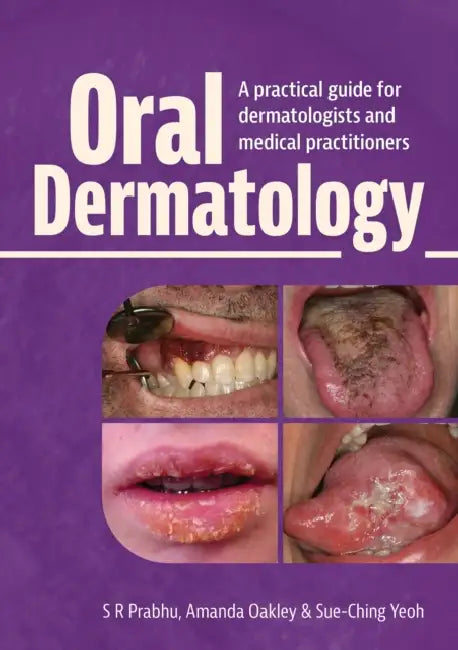 Oral Dermatology by S. R. Prabhu, Amanda Oakley, Sue-Ching Yeoh