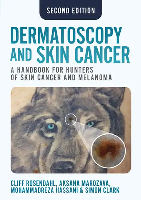 Dermatoscopy and Skin Cancer, second edition: A handbook for hunters of skin cancer and melanoma by Cliff Rosendahl