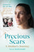 Precious Scars by Julia Engelhorn