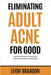 Eliminating Adult Acne for Good: Regain your self-esteem and confidence without wasting money on ineffective and harmful products. by Leigh Brandon