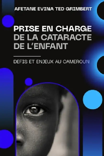 Prise En Charge de la Cataracte de l'Enfant: Defis Et Enjeux Au Cameroun by Afetane Evina Ted