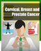 Cervical, Breast and Prostate Cancer by Iconcept Press
