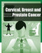 Cervical, Breast and Prostate Cancer (Black and White) by Iconcept Press
